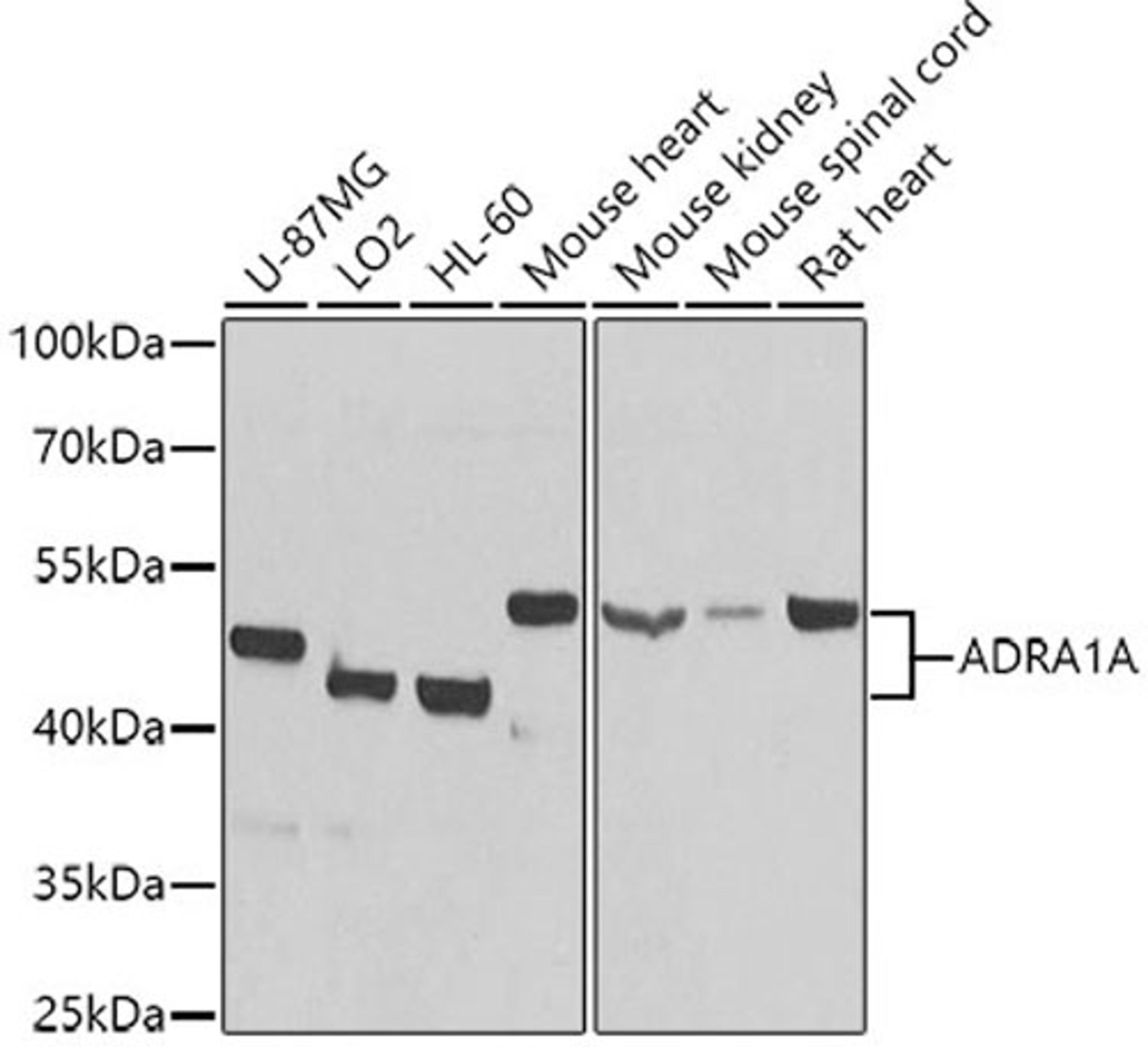 Western blot - ADRA1A antibody (A1471)