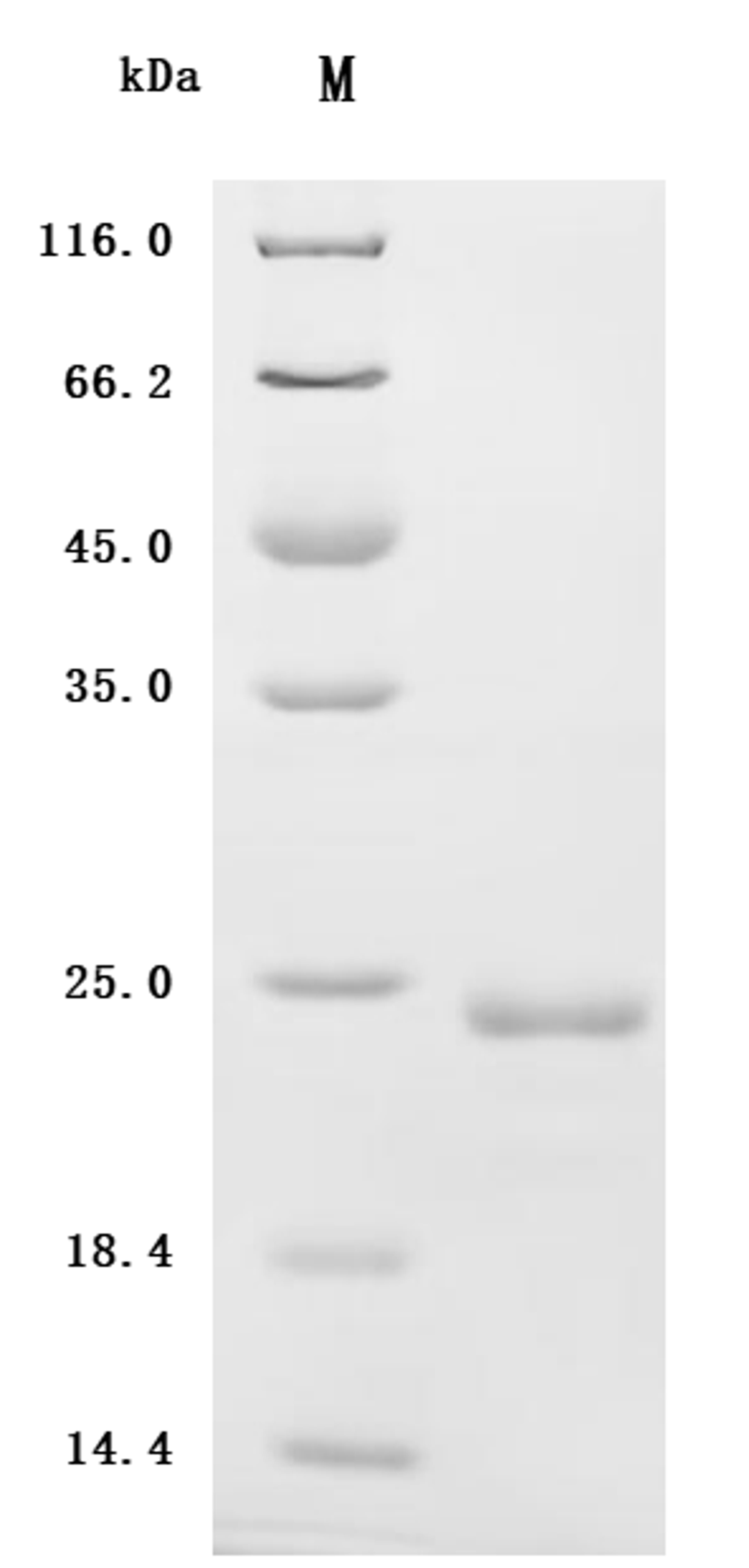 (Tris-Glycine gel) Discontinuous SDS-PAGE (reduced) with 5% enrichment gel and 15% separation gel.