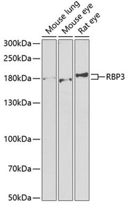 Western blot - RBP3 antibody (A6403)