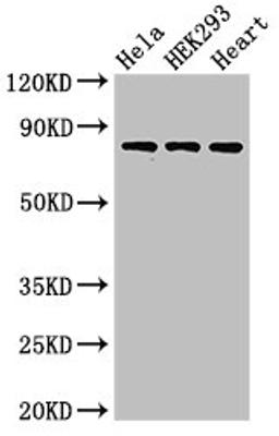 Western Blot. Positive WB detected in: Hela whole cell lysate, HEK293 whole cell lysate, Rat heart tissue. All lanes: C1R antibody at 3ug/ml. Secondary. Goat polyclonal to rabbit IgG at 1/50000 dilution. Predicted band size: 81 kDa. Observed band size: 81 kDa.