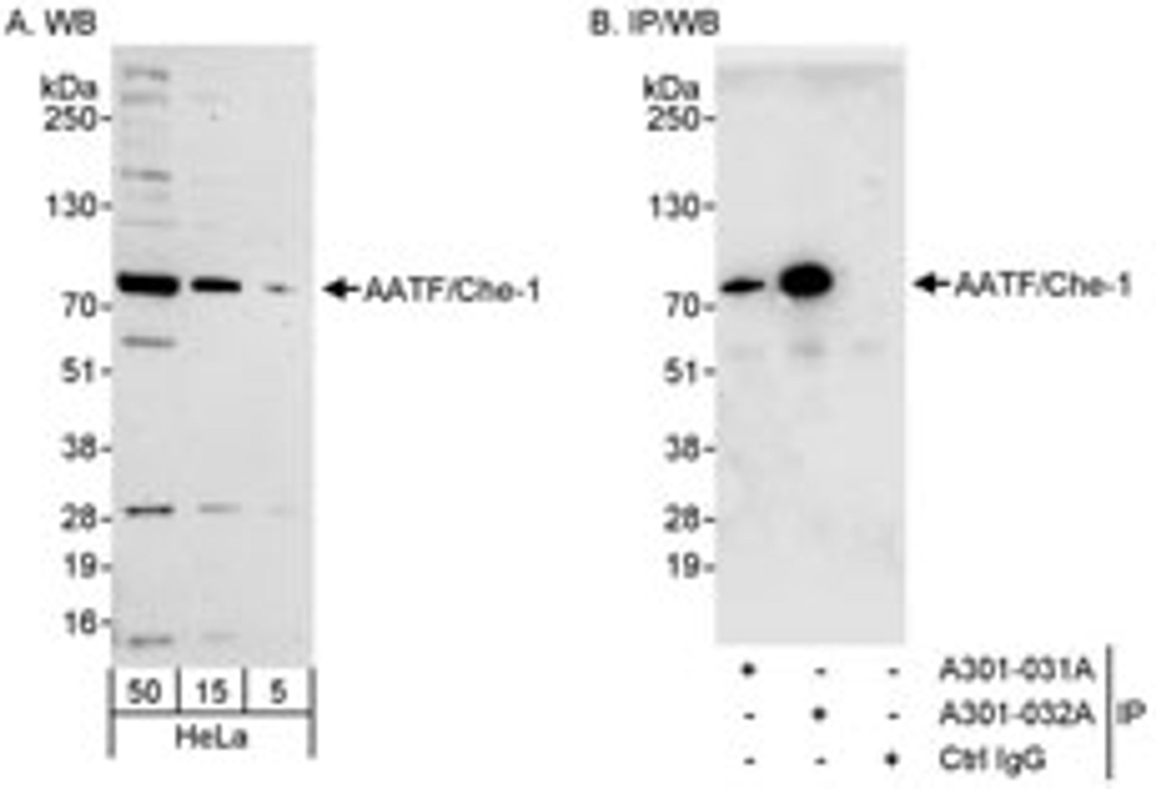 Detection of human AATF/Che-1 by western blot and immunoprecipitation.