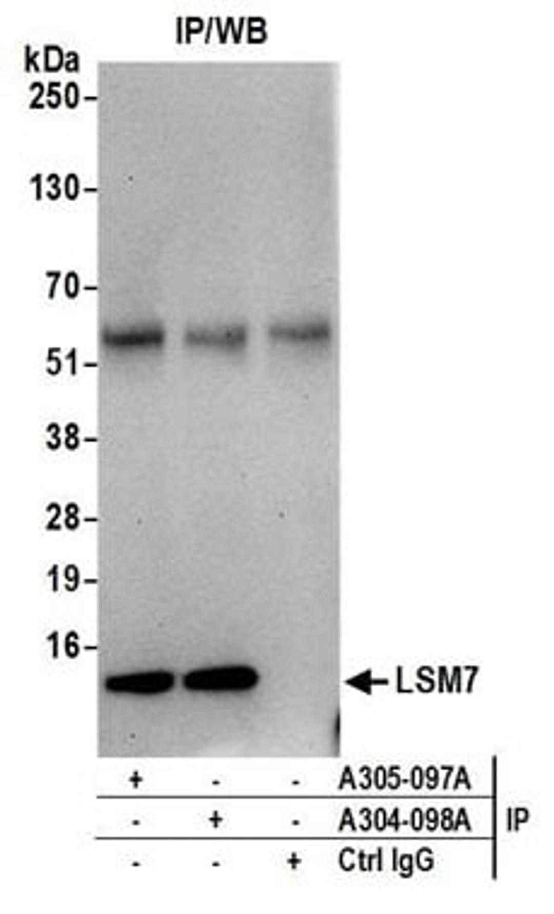 Detection of human LSM7 by western blot of immunoprecipitates.