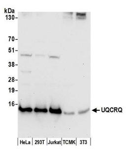 Detection of human and mouse UQCRQ by WB.