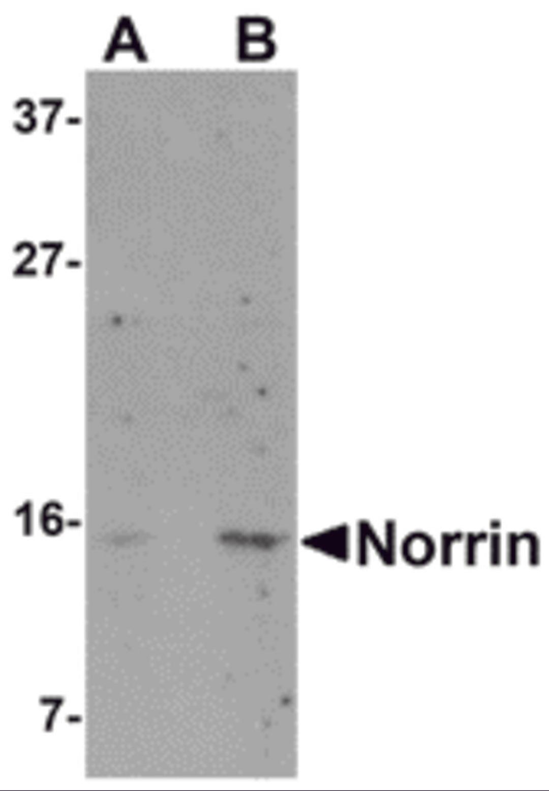 Western blot analysis of Norrin in Jurkat cell lysate with Norrin antibody at (A) 1 and (B) 2 &#956;g/mL.