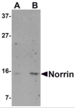 Western blot analysis of Norrin in Jurkat cell lysate with Norrin antibody at (A) 1 and (B) 2 &#956;g/mL.