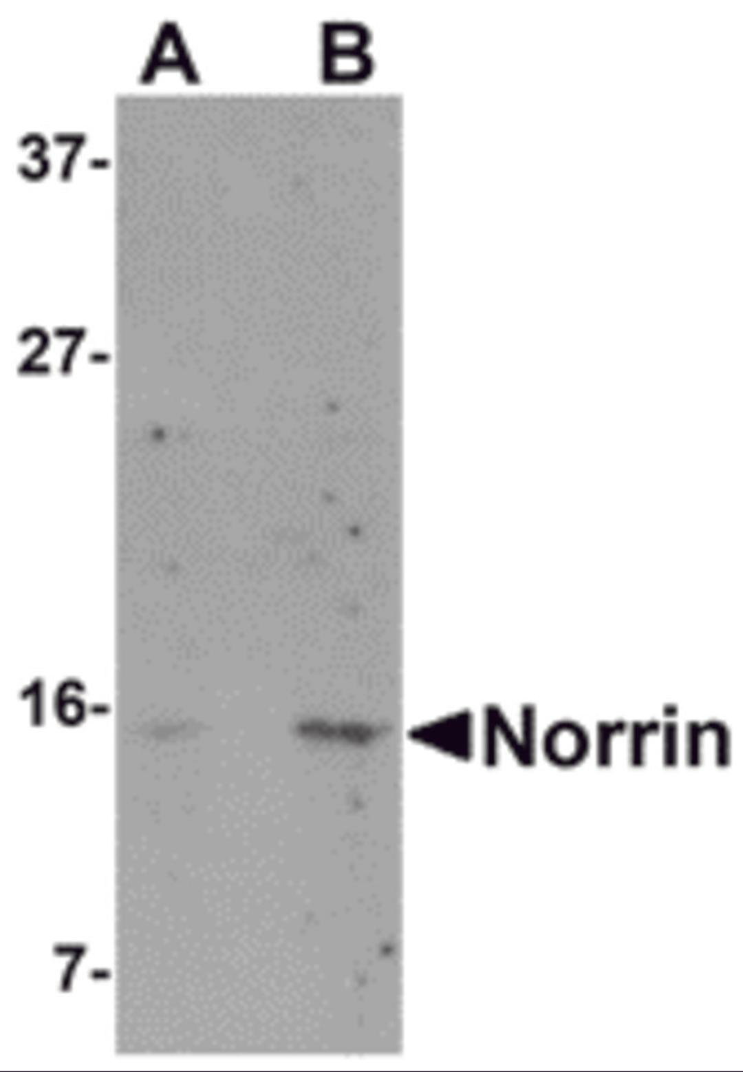 Western blot analysis of Norrin in Jurkat cell lysate with Norrin antibody at (A) 1 and (B) 2 μg/mL.