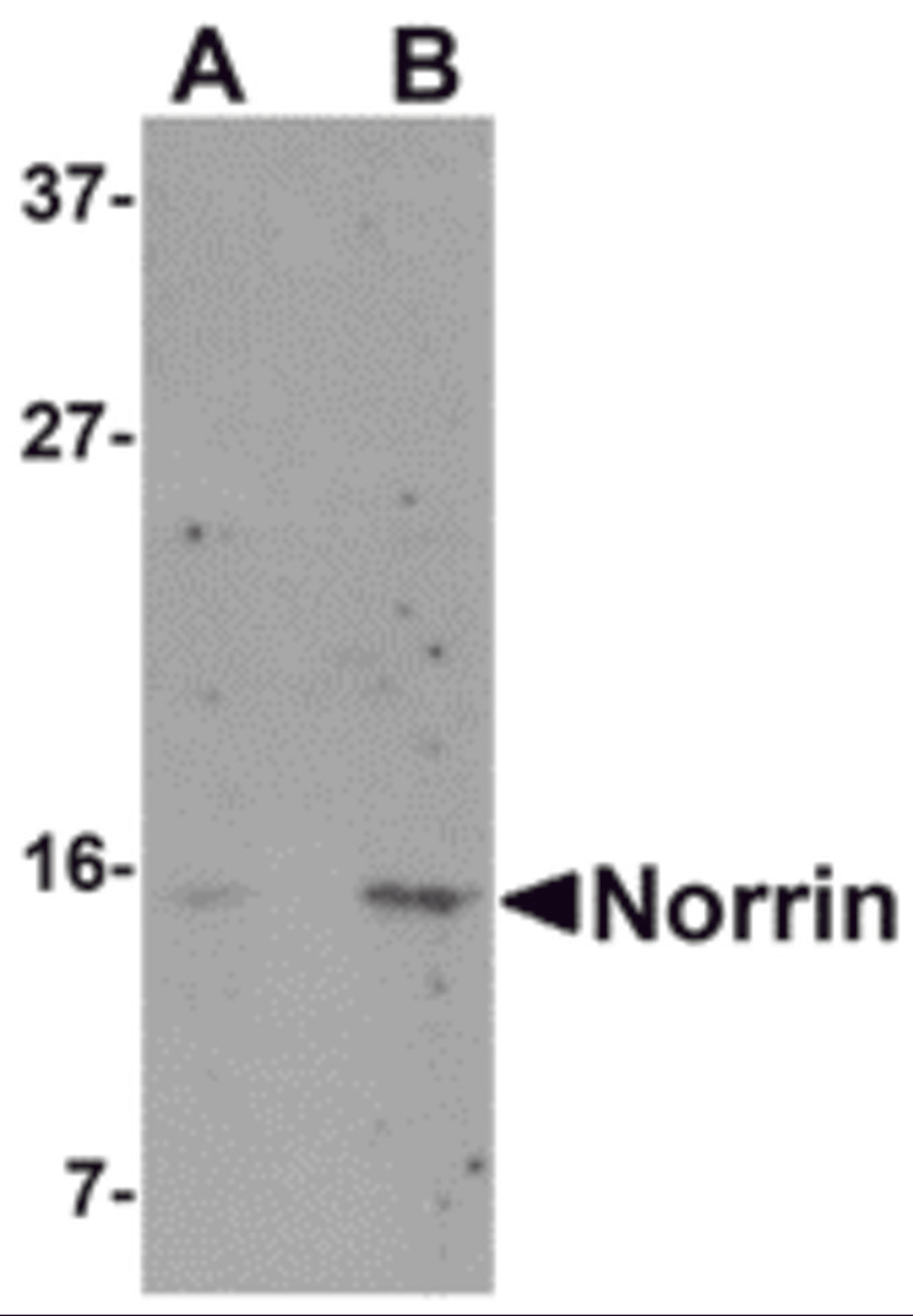 Western blot analysis of Norrin in Jurkat cell lysate with Norrin antibody at (A) 1 and (B) 2 μg/mL.