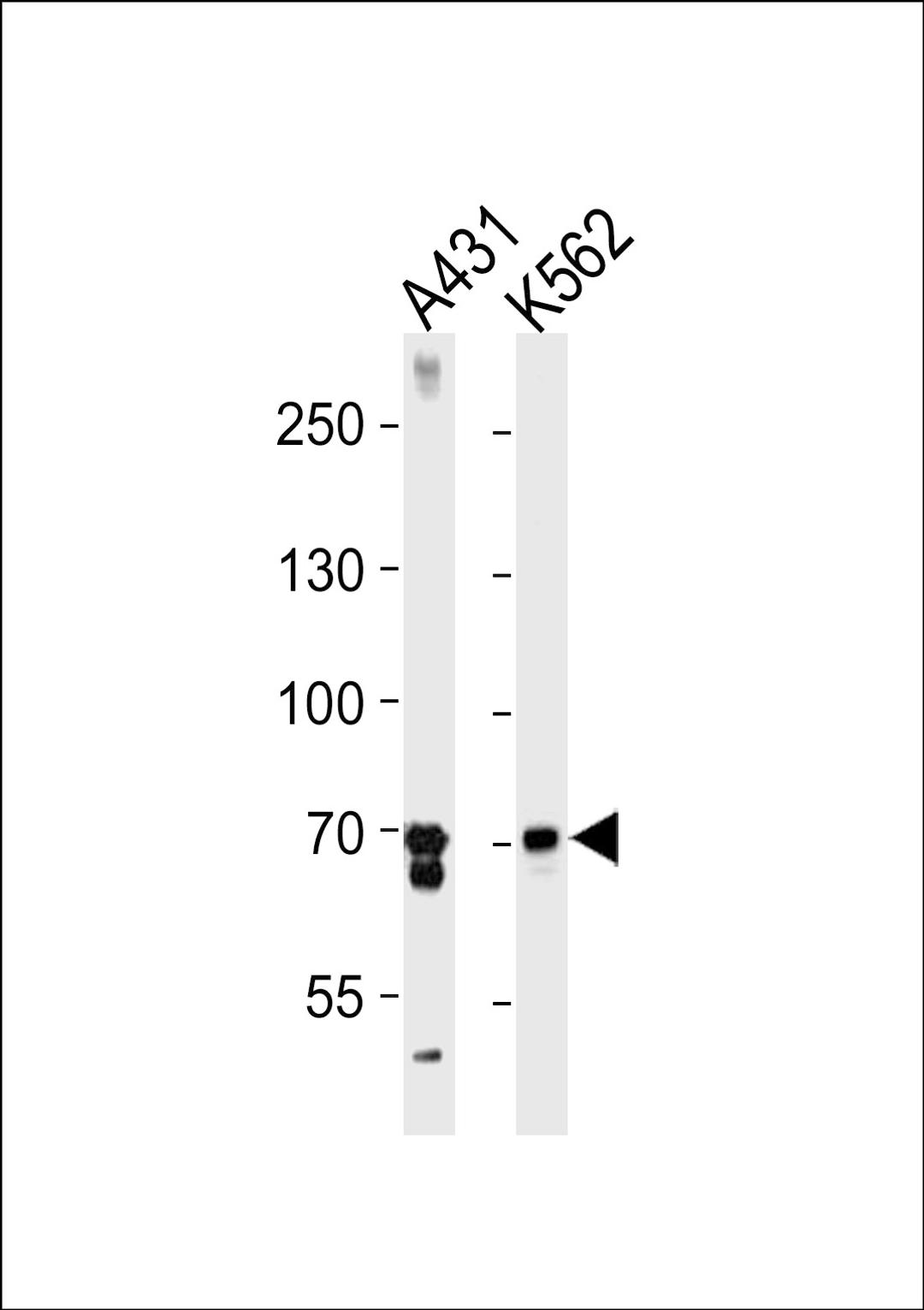 Western blot analysis in A431,K562 cell line lysates (35ug/lane).