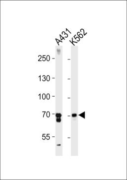 Western blot analysis in A431,K562 cell line lysates (35ug/lane).