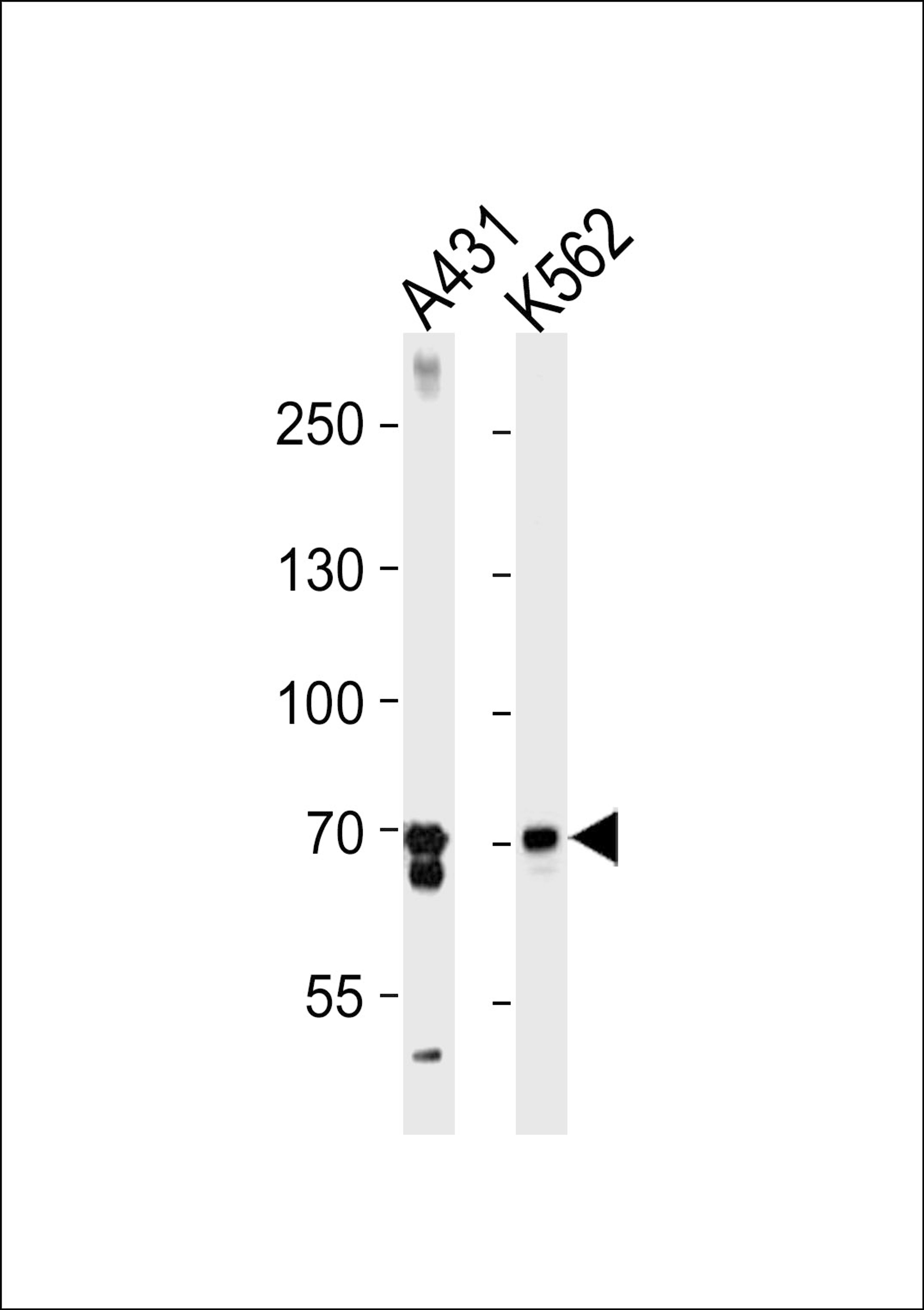 Western blot analysis in A431,K562 cell line lysates (35ug/lane).