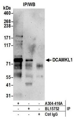 Detection of human DCAMKL1 by western blot of immunoprecipitates.