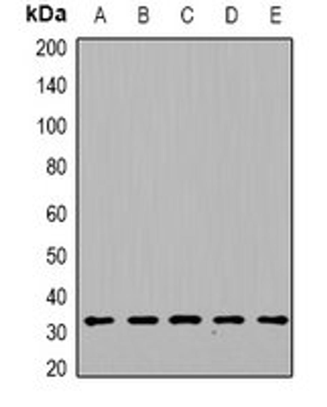 Western blot analysis of HepG2 (Lane1), mouse heart (Lane2), mouse kidney (Lane3), rat liver (Lane4), rat brain (Lane5) whole cell lysates using DGUOK antibody