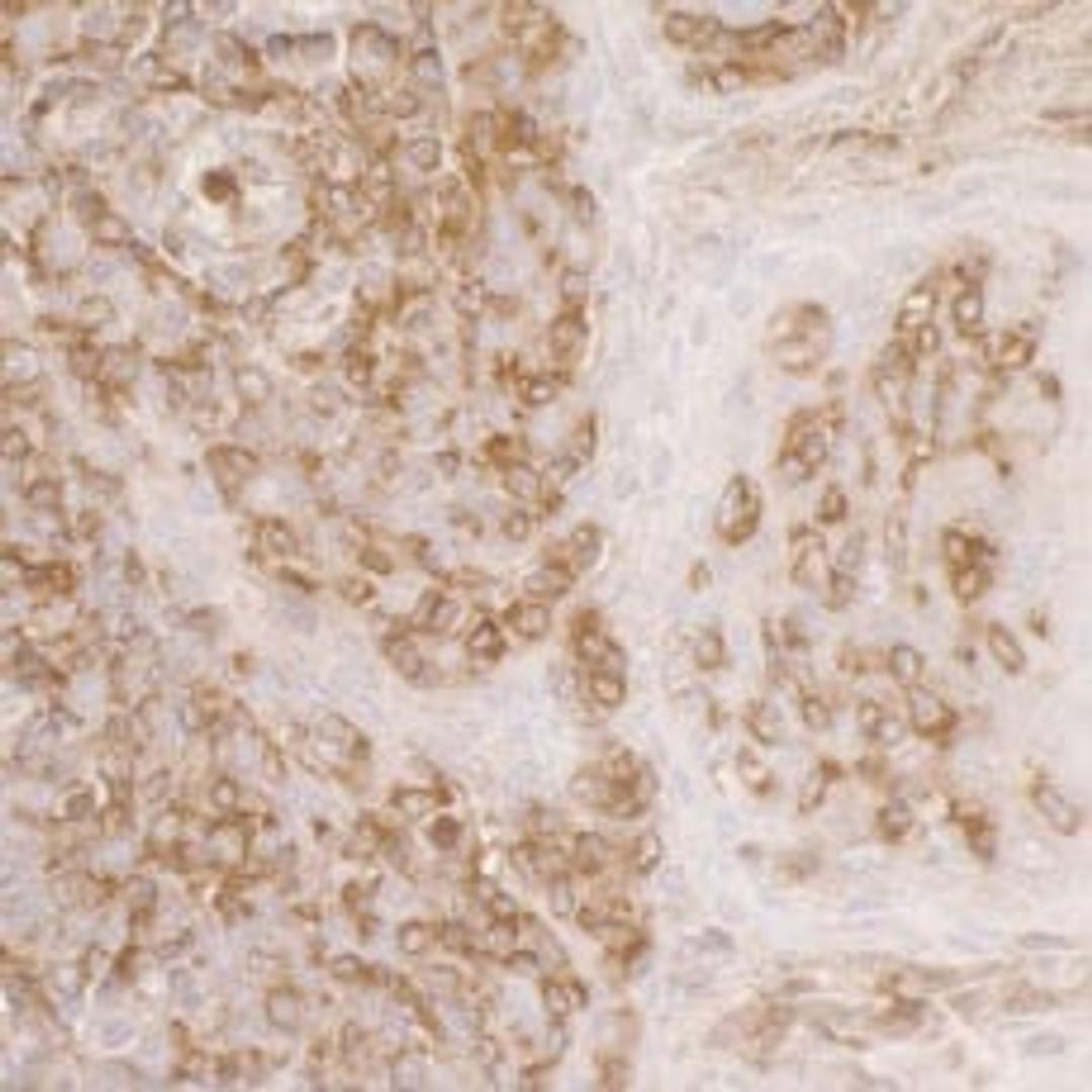 Detection of human ACTR2 by immunohistochemistry.