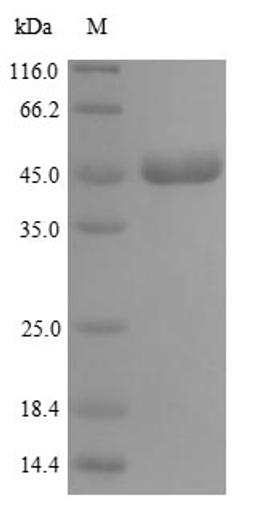 (Tris-Glycine gel) Discontinuous SDS-PAGE (reduced) with 5% enrichment gel and 15% separation gel.