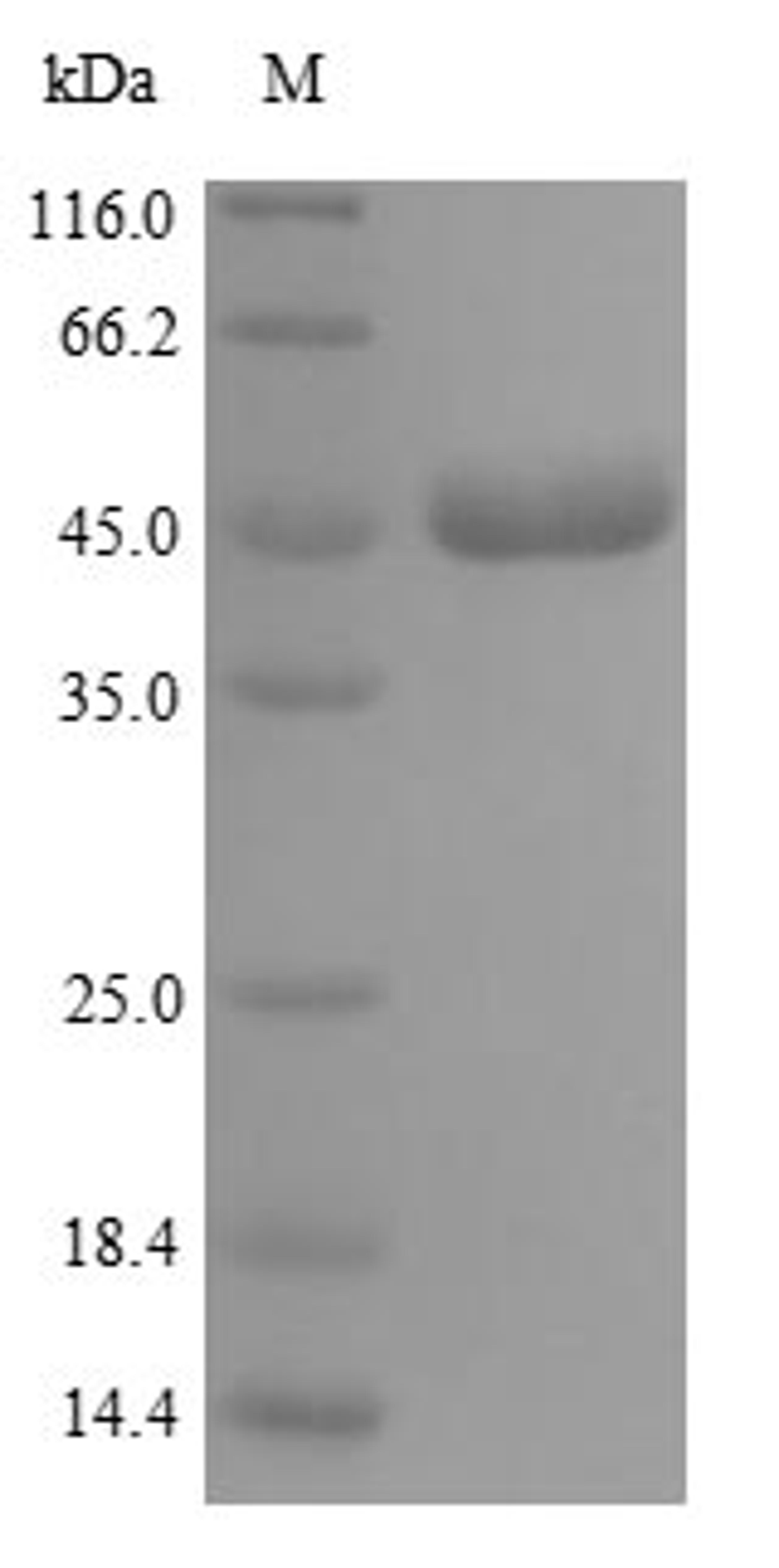 (Tris-Glycine gel) Discontinuous SDS-PAGE (reduced) with 5% enrichment gel and 15% separation gel.