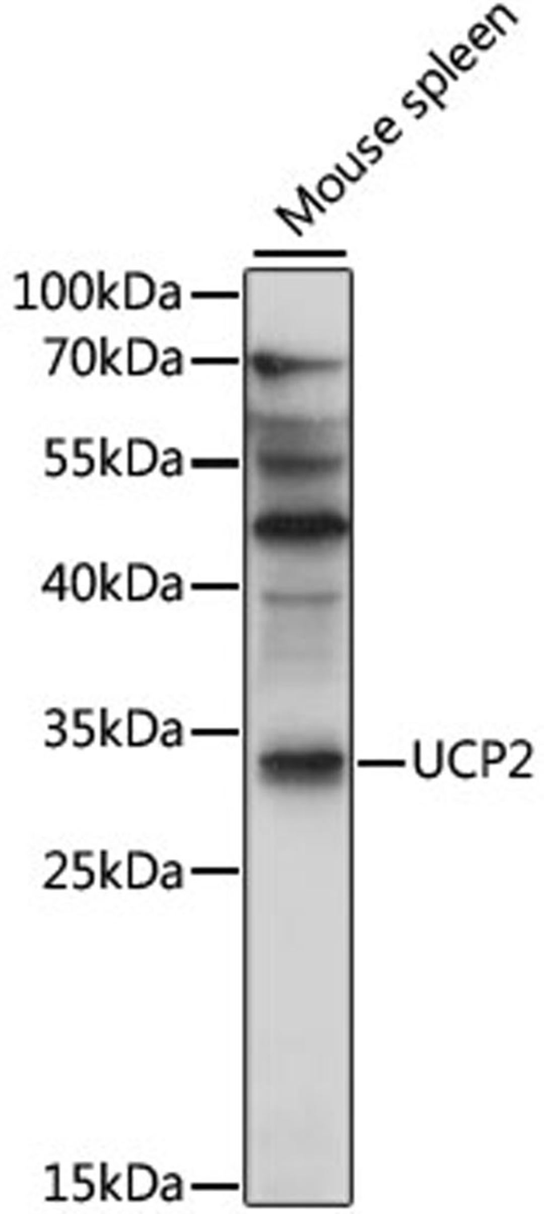 Western blot - UCP2 antibody (A4178)