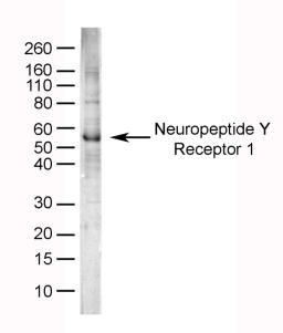 Human brain lysate probed with Sheep anti Human Neuropeptide Y Receptor 1 (6732-0150)