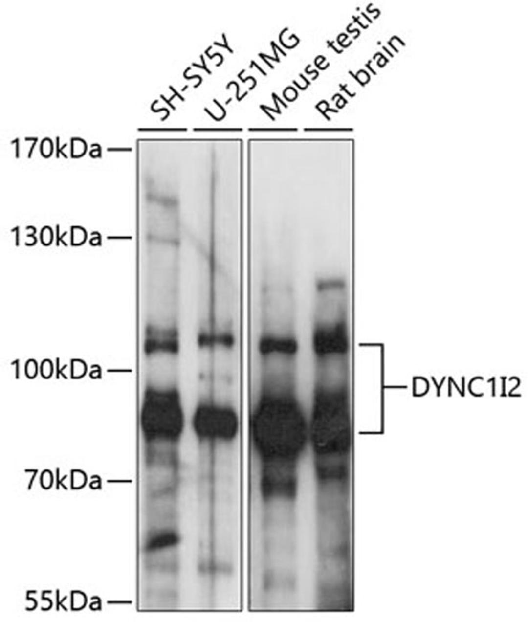 Western blot - DYNC1I2 antibody (A14725)