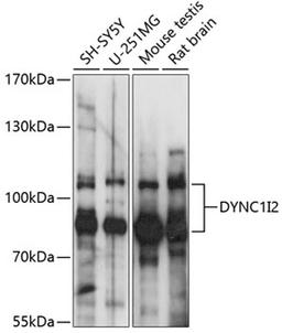 Western blot - DYNC1I2 antibody (A14725)