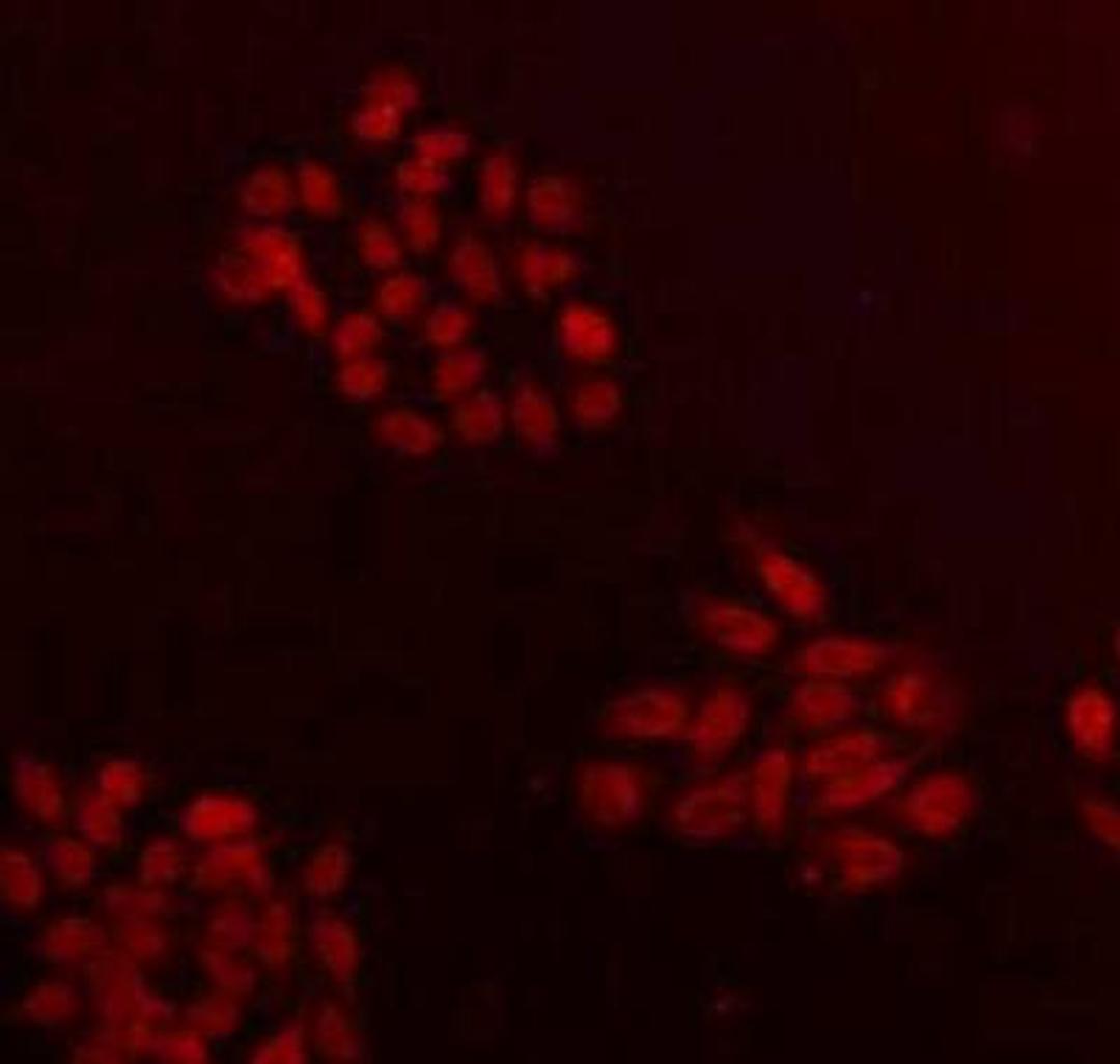 Immunofluorescent staining of HepG2 (red) Cells using CCDC111 antibody