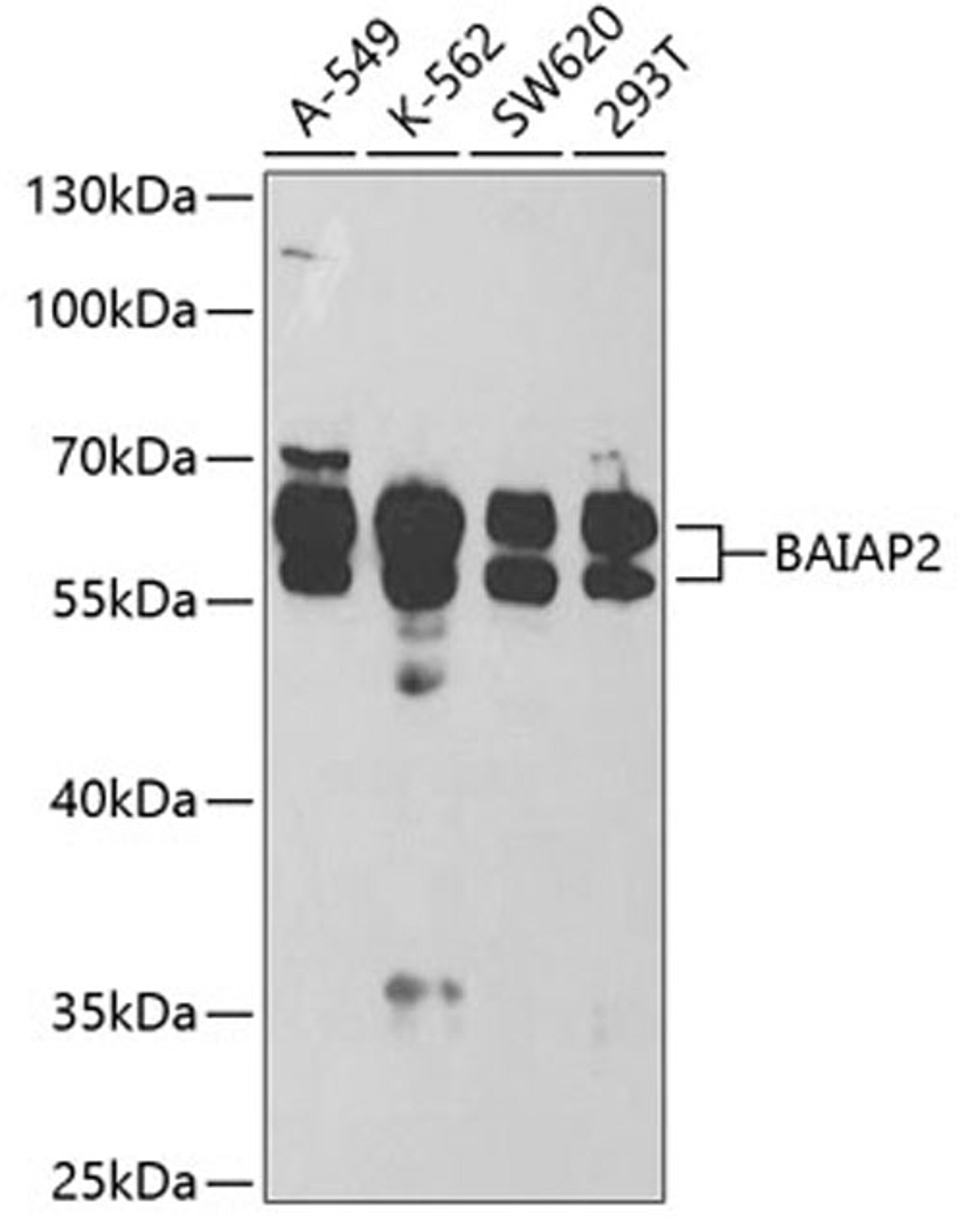 Western blot - BAIAP2 antibody (A5337)