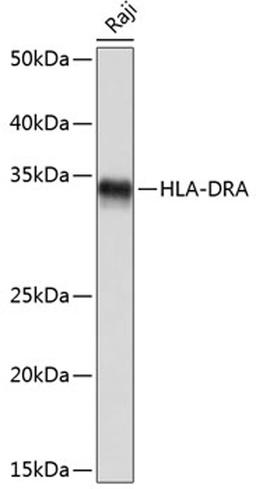 Western blot - HLA-DRA Rabbit mAb (A10863)