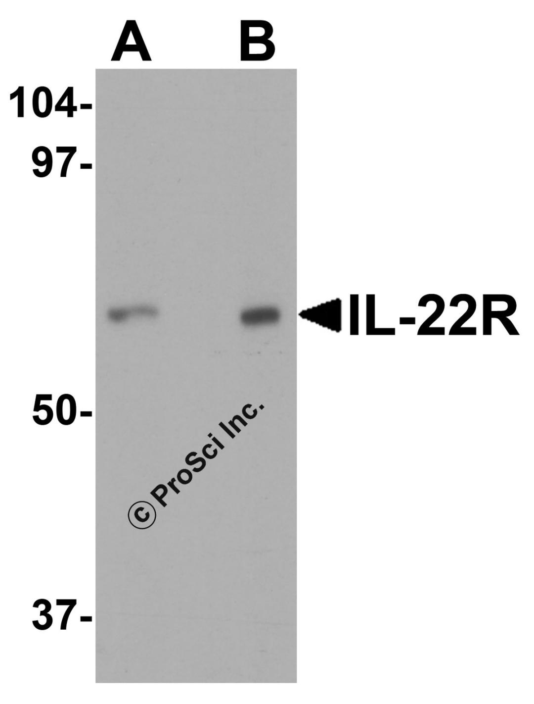 Western blot analysis of IL-22 receptor expression in human HepG2 cell lysate with IL-22 receptor antibody at (A) 0.5 and (B) 1 &#956;g /ml.