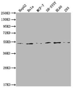 Western Blot. Positive WB detected in: HepG2 whole cell lysate, Hela whole cell lysate, MCF-7 whole cell lysate, SH-SY5Y whole cell lysate, HL60 whole cell lysate, 293 whole cell lysate. All lanes: PPARA antibody at 1:2000. Secondary. Goat polyclonal to rabbit IgG at 1/50000 dilution. Predicted band size: 53, 19 kDa. Observed band size: 53 kDa.