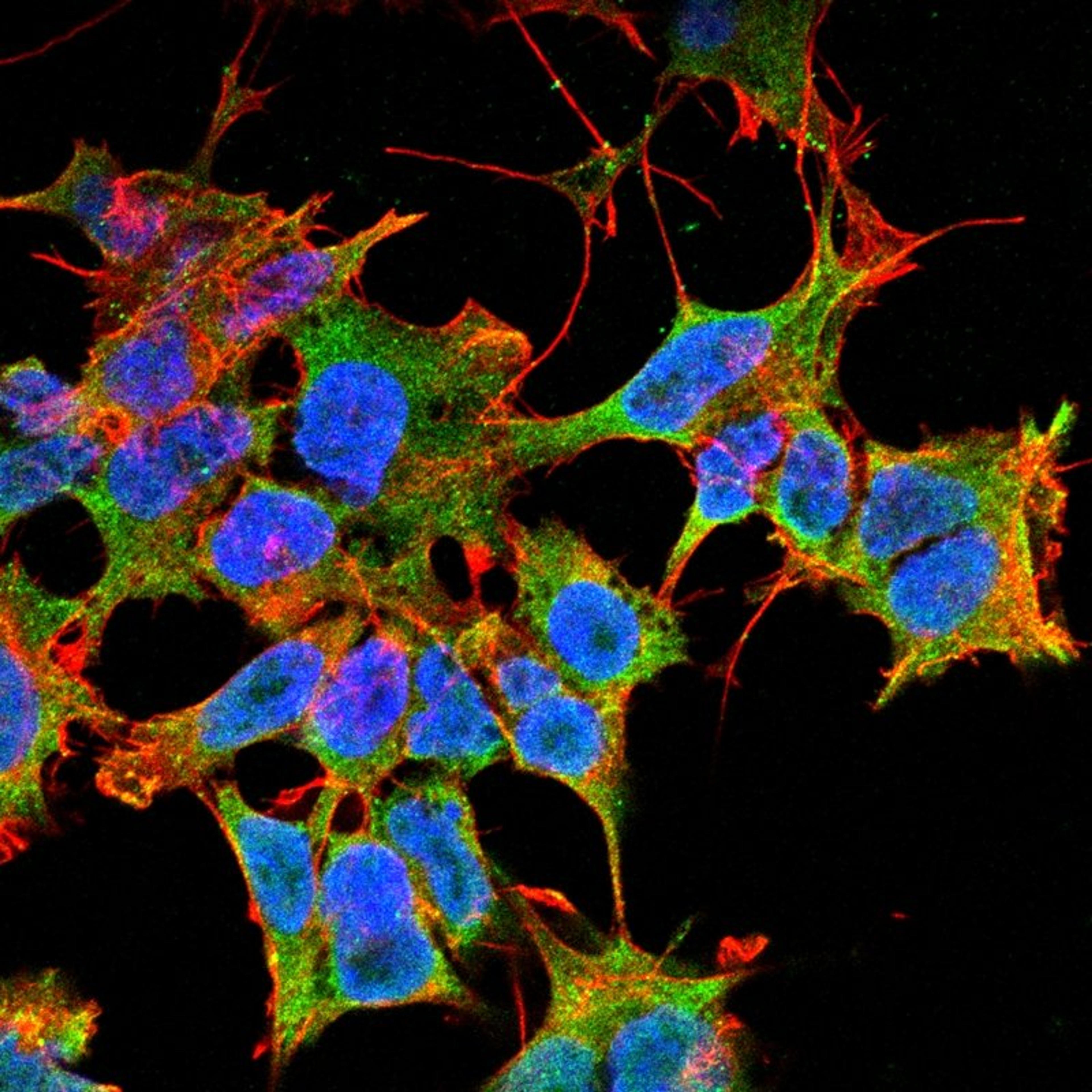 Immunofluorescence analysis of neuroblastoma cell line sk-n-be using LGI1 antibody