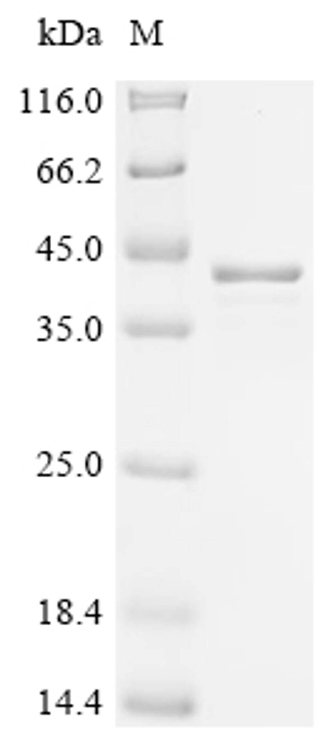 (Tris-Glycine gel) Discontinuous SDS-PAGE (reduced) with 5% enrichment gel and 15% separation gel.