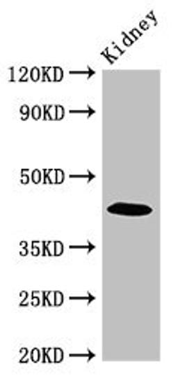Western Blot. Positive WB detected in: Mouse kidney tissue. All lanes: PALM antibody at 2.7ug/ml. Secondary. Goat polyclonal to rabbit IgG at 1/50000 dilution. Predicted band size: 43, 38 kDa. Observed band size: 43 kDa. 