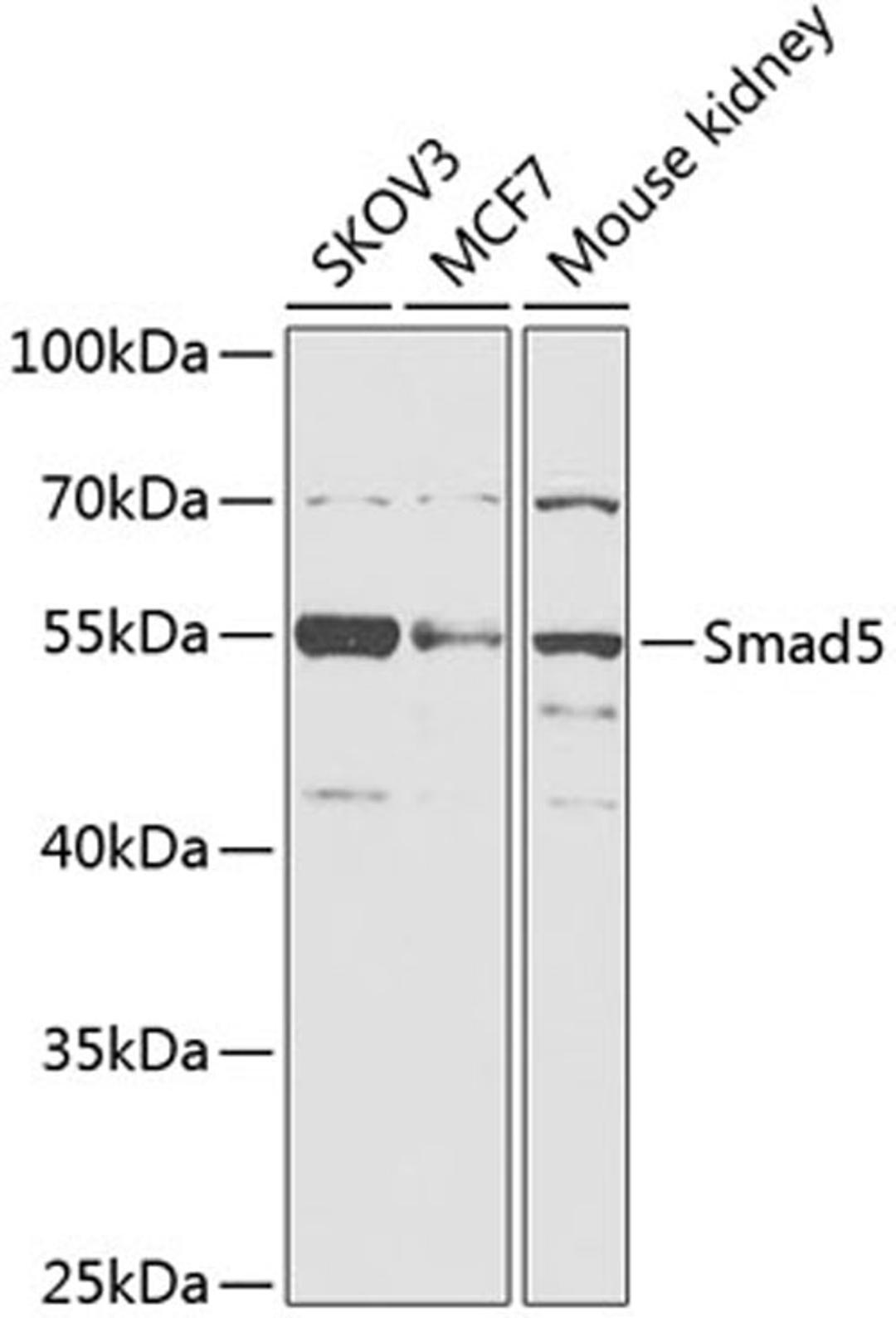 Western blot - Smad5 antibody (A14023)