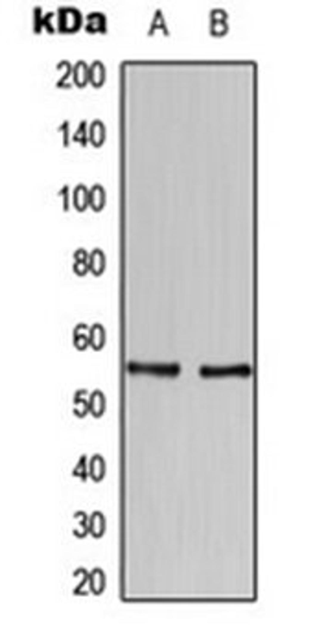 Western blot analysis of SKBR3 (Lane 1), U937 (Lane 2) whole cell lysates using HBP1 antibody