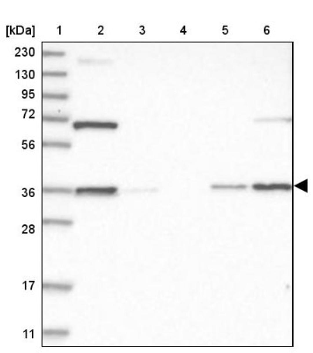 Western Blot: Annexin A9 Antibody [NBP1-90152] - Lane 1: Marker [kDa] 230, 130, 95, 72, 56, 36, 28, 17, 11<br/>Lane 2: Human cell line RT-4<br/>Lane 3: Human cell line U-251MG sp<br/>Lane 4: Human plasma (IgG/HSA depleted)<br/>Lane 5: Human liver tissue<br/>Lane 6: Human tonsil tissue