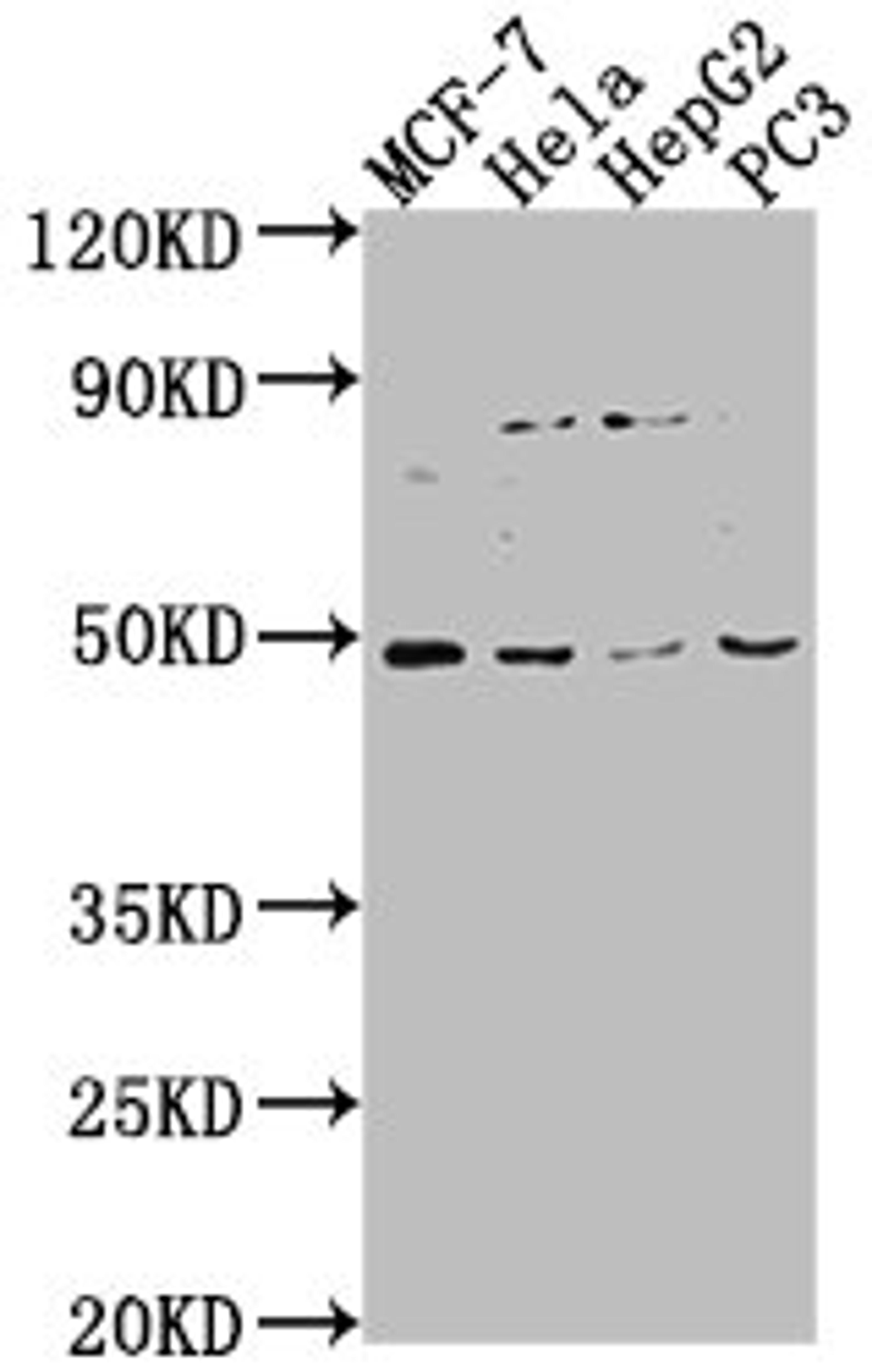 Western Blot. Positive WB detected in: MCF-7 whole cell lysate, Hela whole cell lysate, HepG2 whole cell lysate, PC-3 whole cell lysate. All lanes: PAX8 antibody at 1:2000. Secondary. Goat polyclonal to rabbit IgG at 1/50000 dilution. Predicted band size: 49, 42, 44, 35, 32 kDa. Observed band size: 49 kDa. 