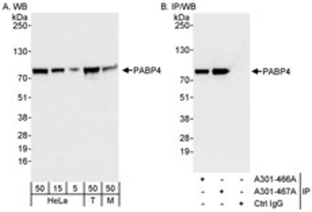 Detection of human and mouse PABP4 by western blot (h&m) and immunoprecipitation (h).