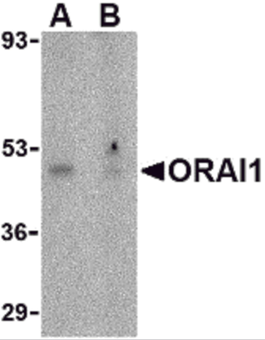 Western blot analysis of ORAI1 in human ovary tissue lysate with ORAI1 antibody at 1 μg/mL in the (A) absence or (B) presence of blocking peptide.