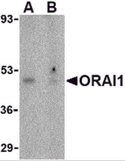 Western blot analysis of ORAI1 in human ovary tissue lysate with ORAI1 antibody at 1 μg/mL in the (A) absence or (B) presence of blocking peptide.