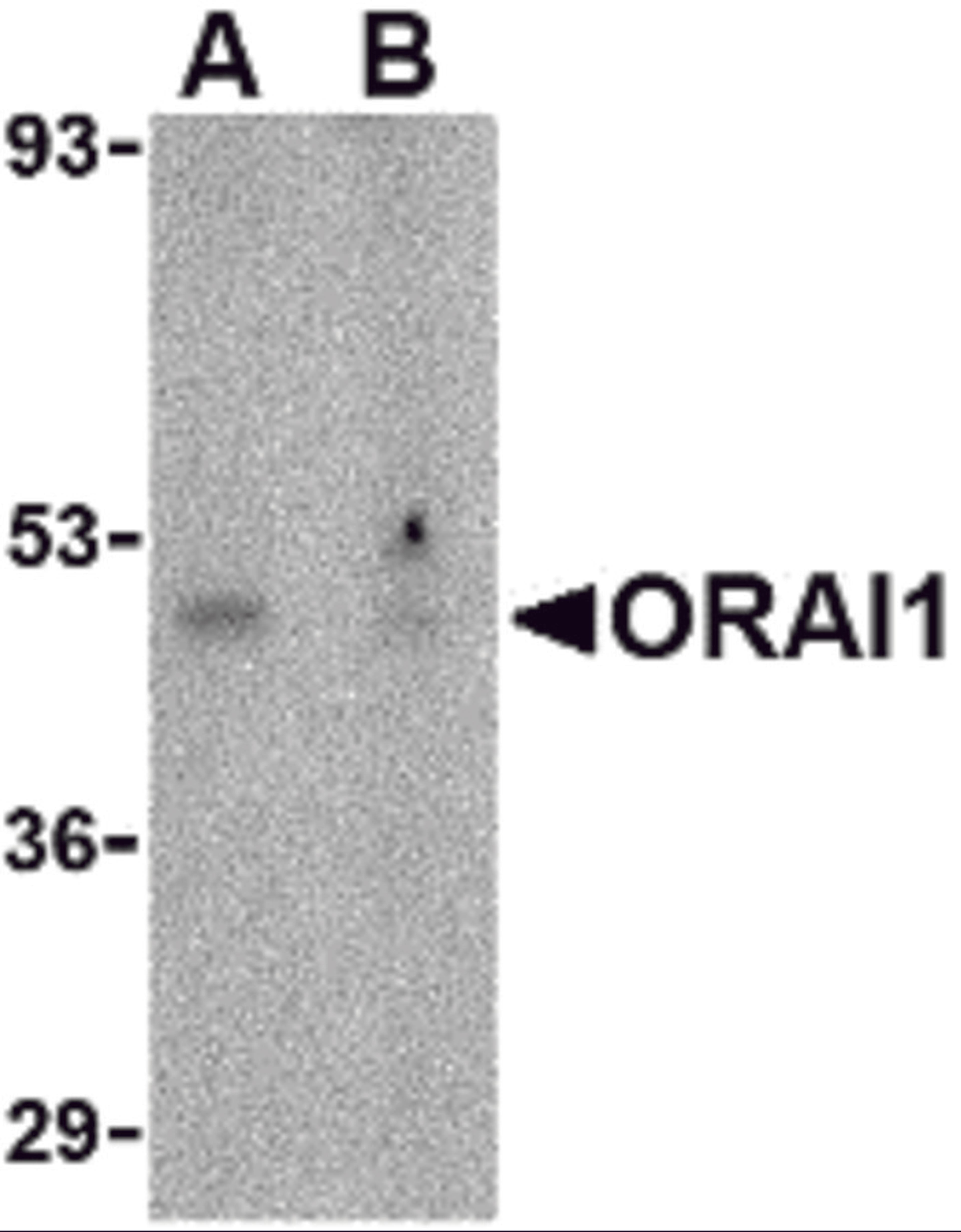 Western blot analysis of ORAI1 in human ovary tissue lysate with ORAI1 antibody at 1 μg/mL in the (A) absence or (B) presence of blocking peptide.
