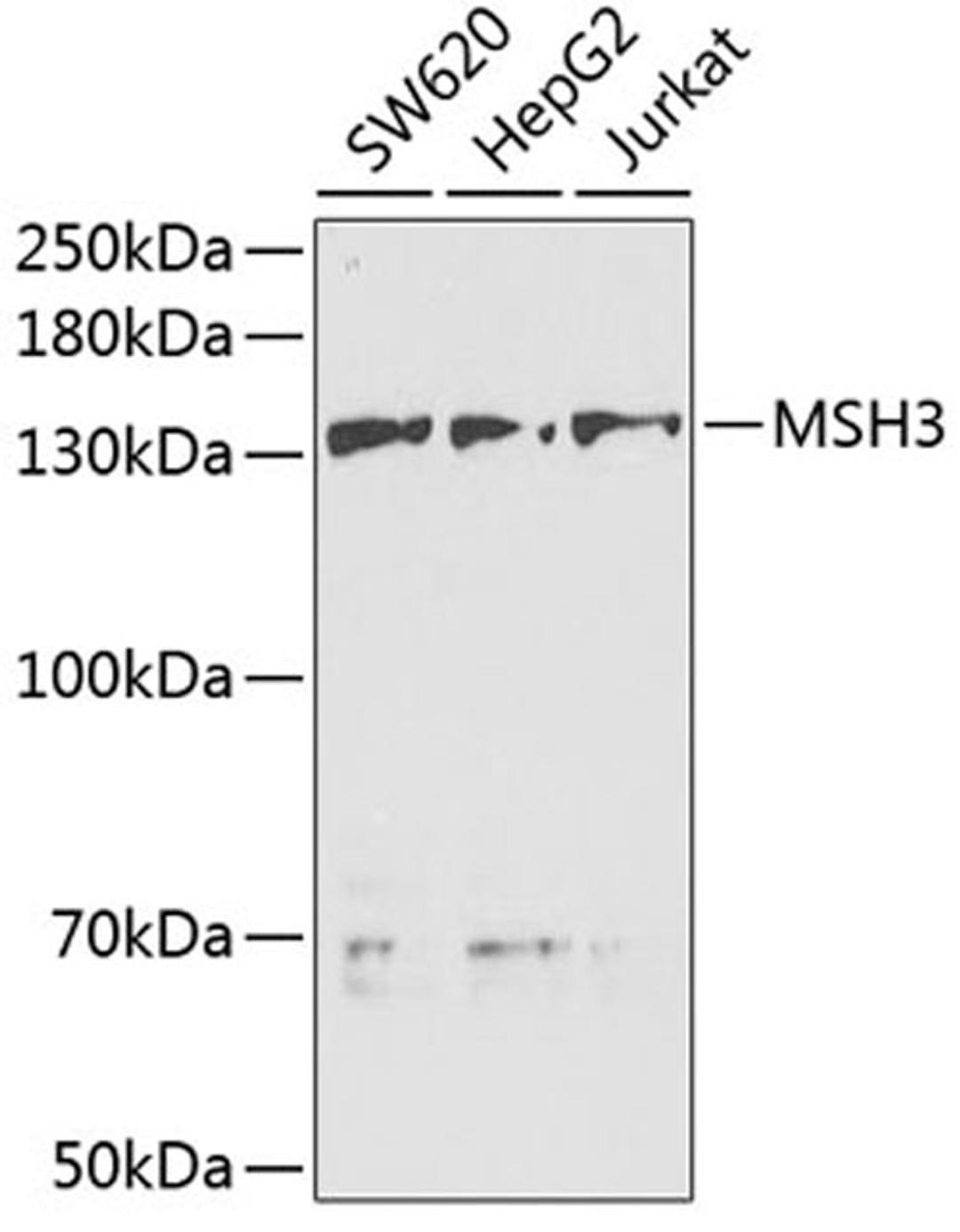 Western blot - MSH3 antibody (A5681)