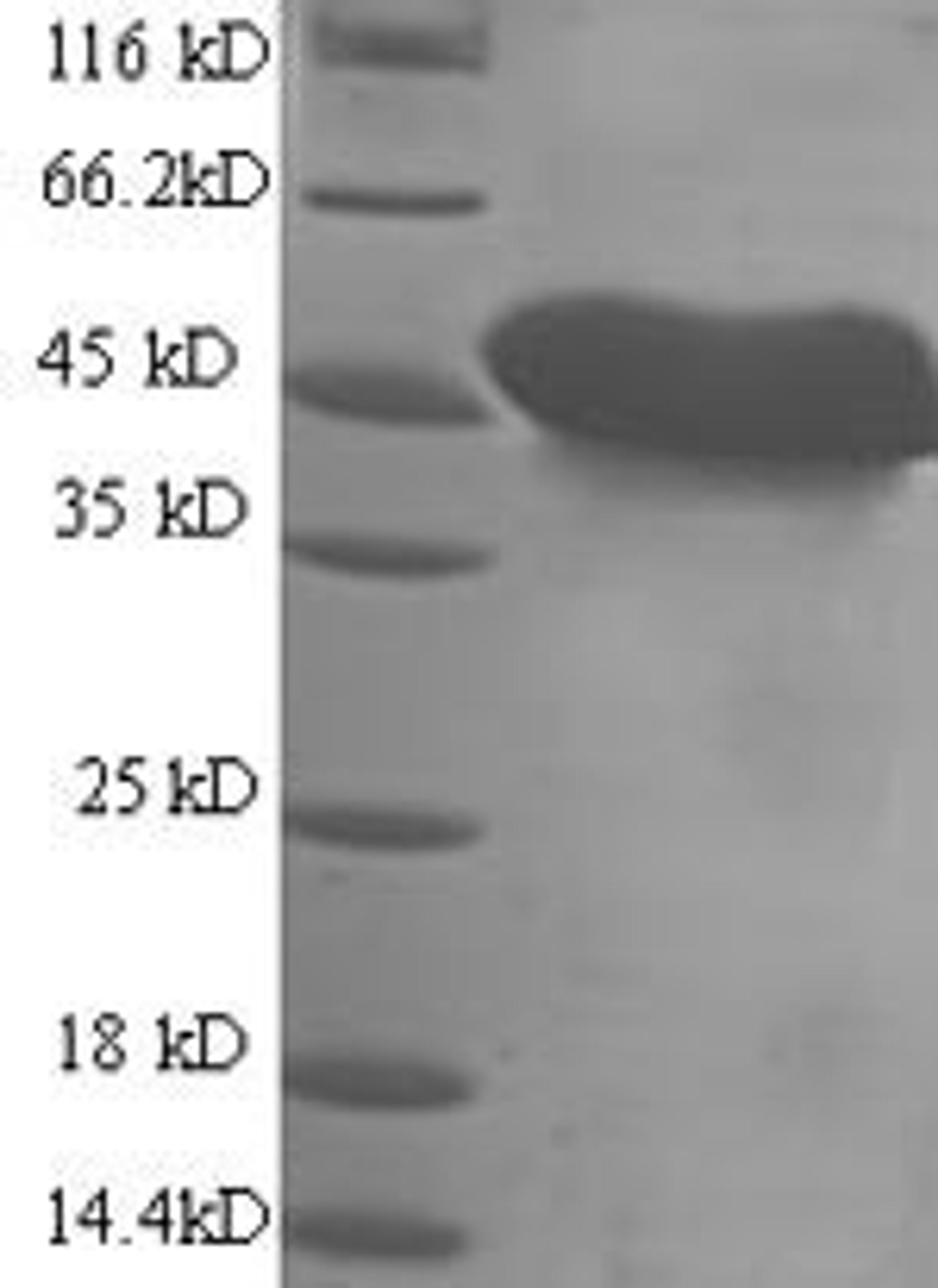 (Tris-Glycine gel) Discontinuous SDS-PAGE (reduced) with 5% enrichment gel and 15% separation gel.
