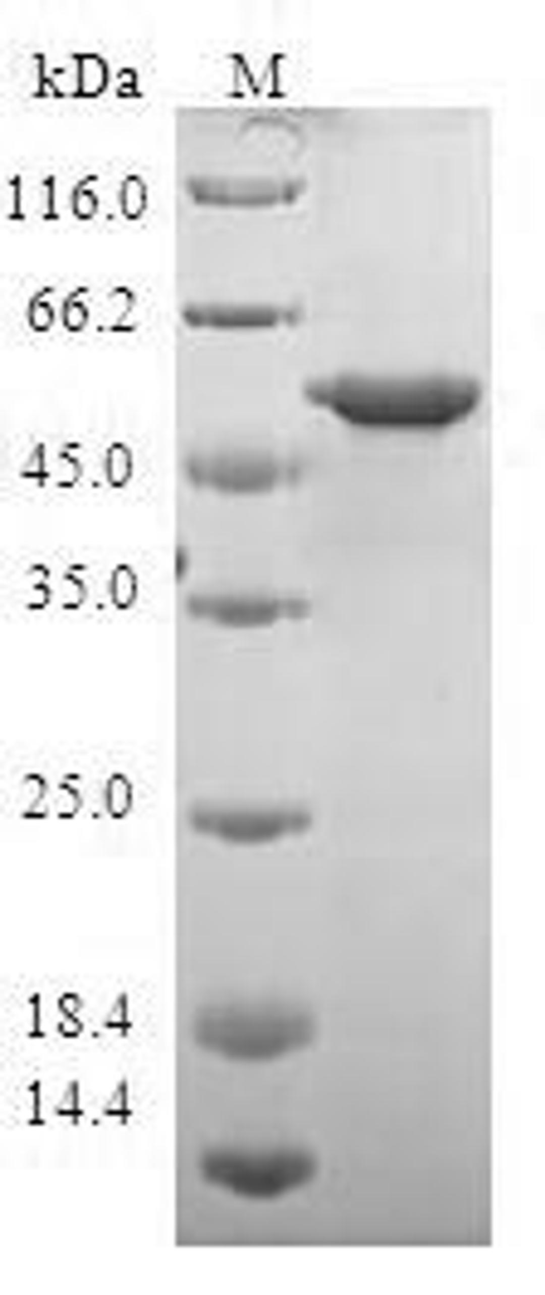 (Tris-Glycine gel) Discontinuous SDS-PAGE (reduced) with 5% enrichment gel and 15% separation gel.