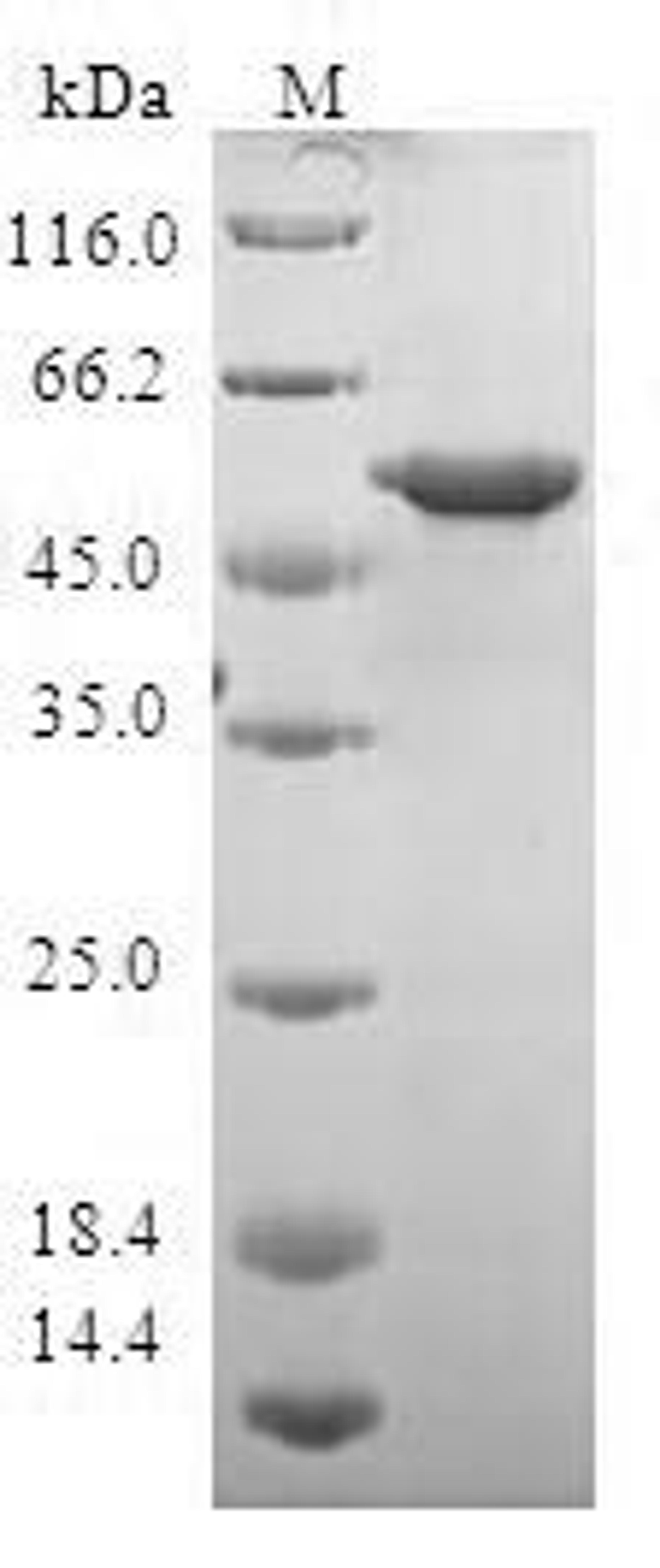 (Tris-Glycine gel) Discontinuous SDS-PAGE (reduced) with 5% enrichment gel and 15% separation gel.