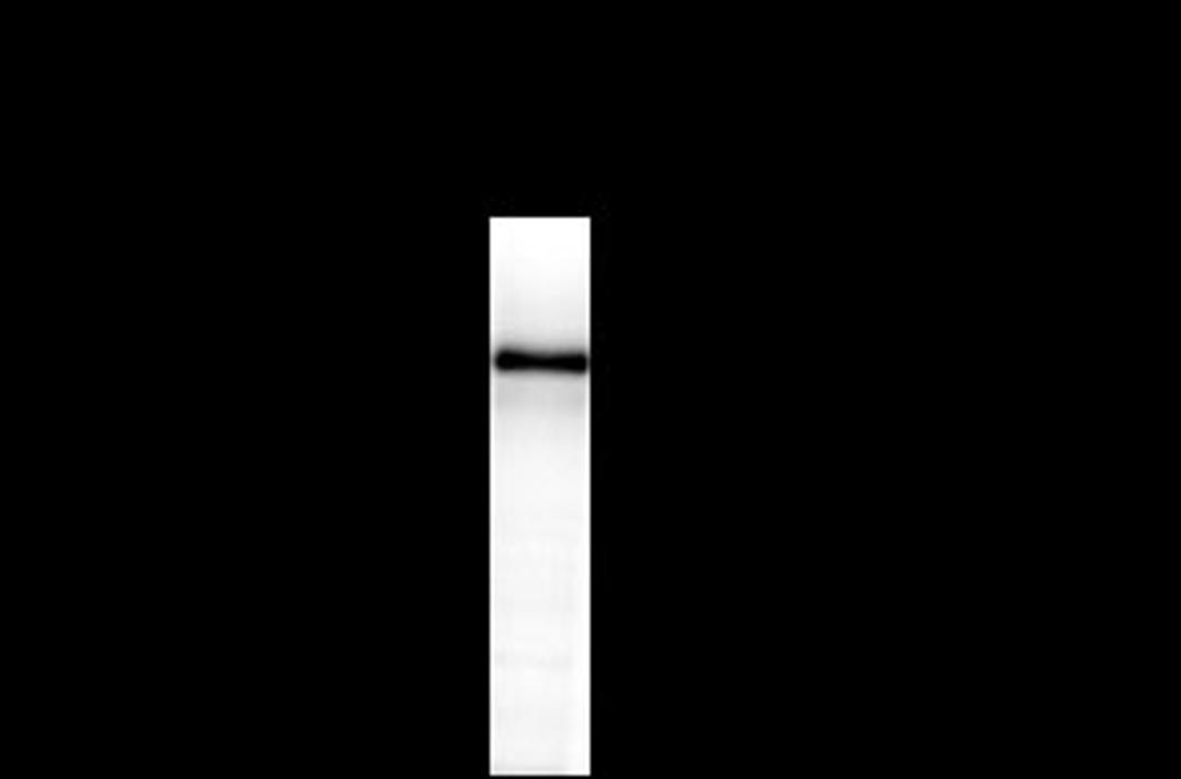 NMDA NR2B Subunit Antibody