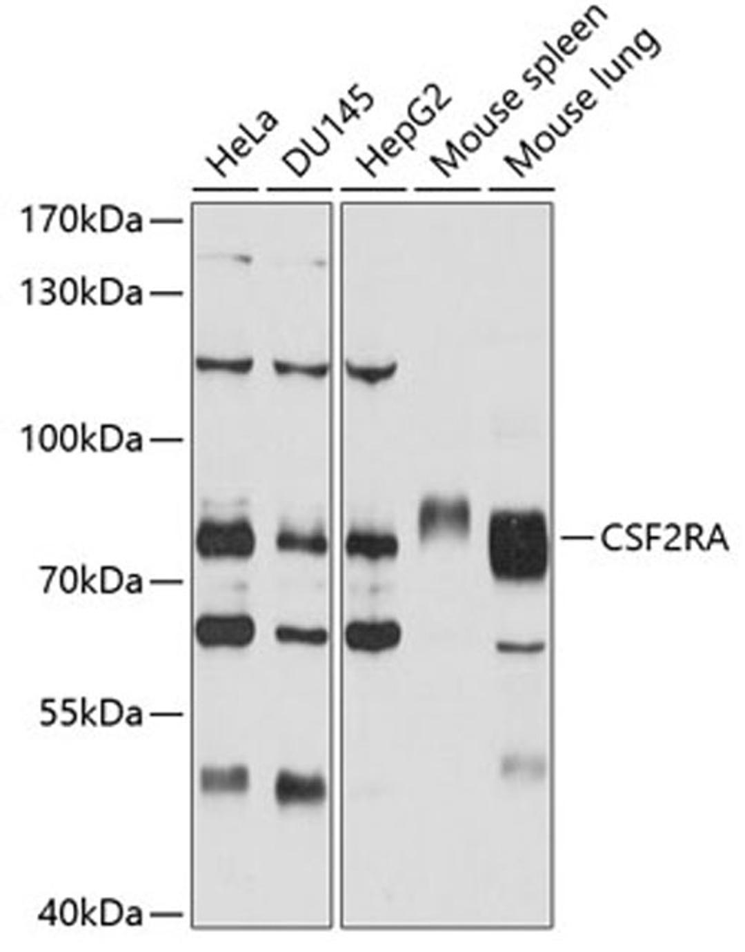 Western blot - CSF2RA antibody (A2034)