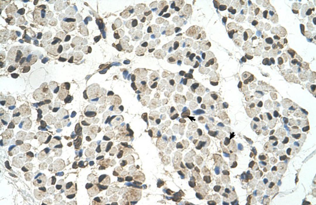 Antibody used in IHC on Human Muscle.