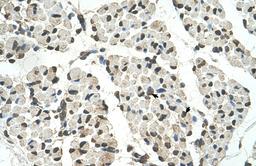 Antibody used in IHC on Human Muscle.