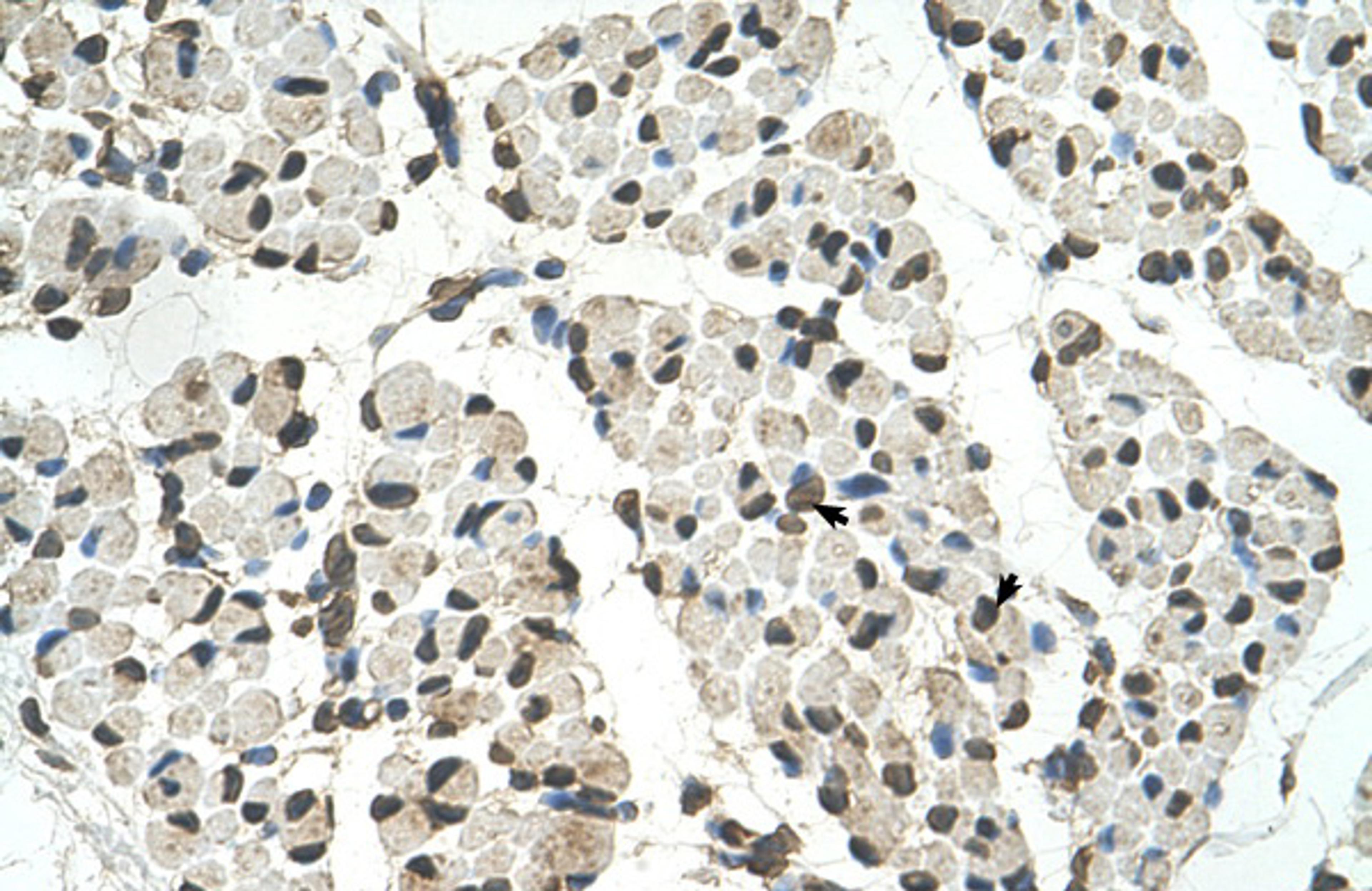 Antibody used in IHC on Human Muscle.