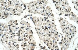 Antibody used in IHC on Human Muscle.