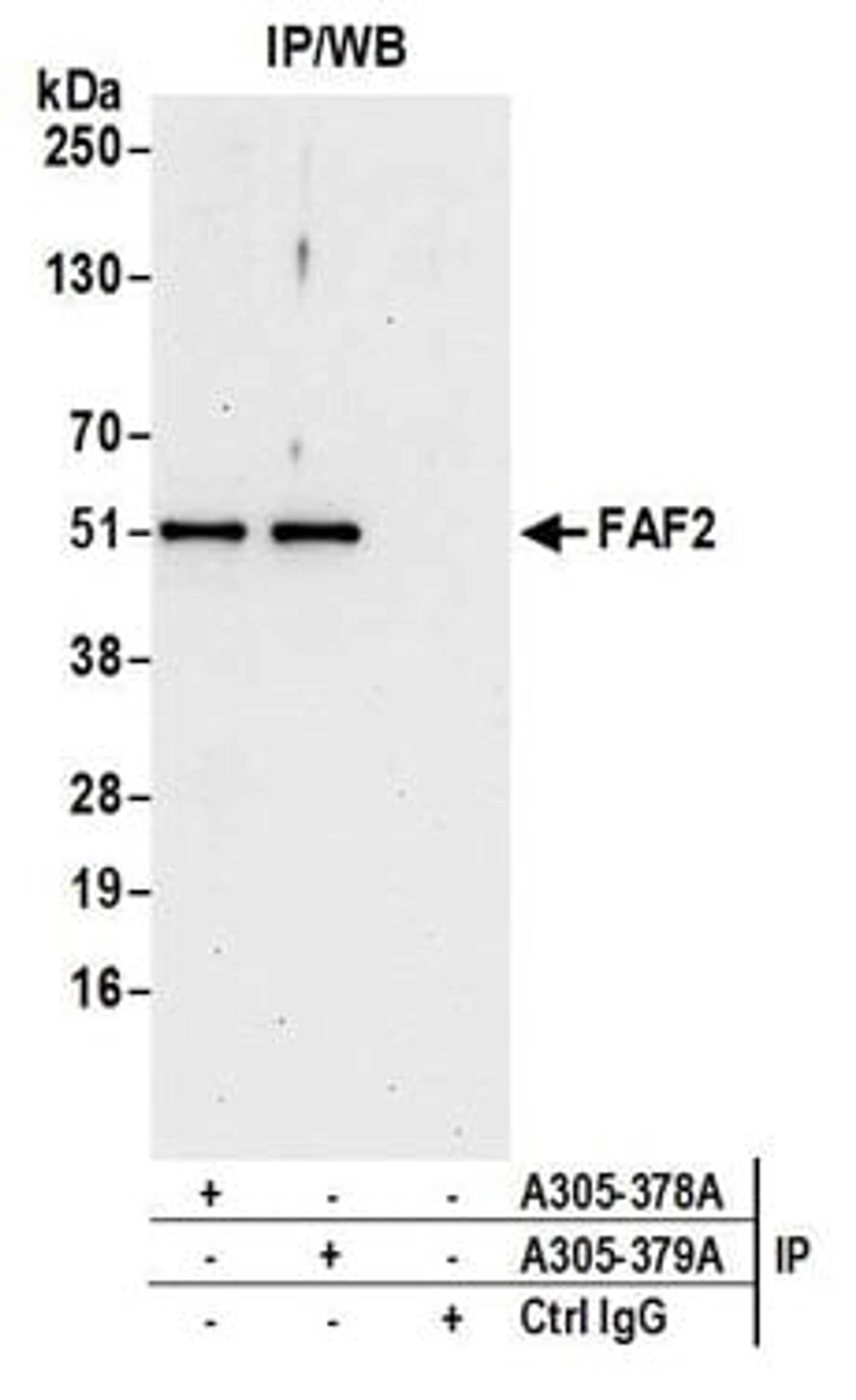 Detection of human FAF2 by western blot of immunoprecipitates.